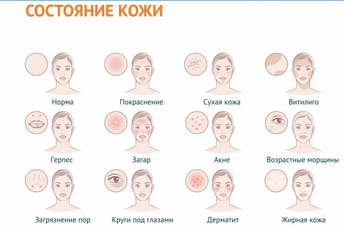 Stan skóry i możliwe choroby