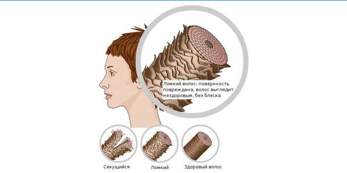 Struktura łamliwych i zdrowych włosów
